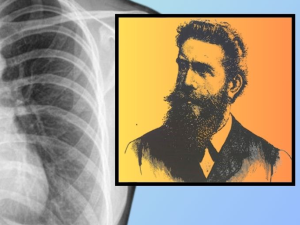 Dari mana X-Ray muncul