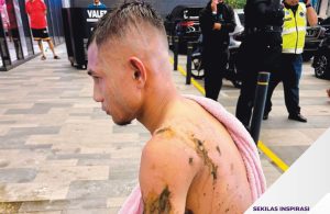 Cedera disimbah asid, Faisal kecewa siasatan hanya NFA